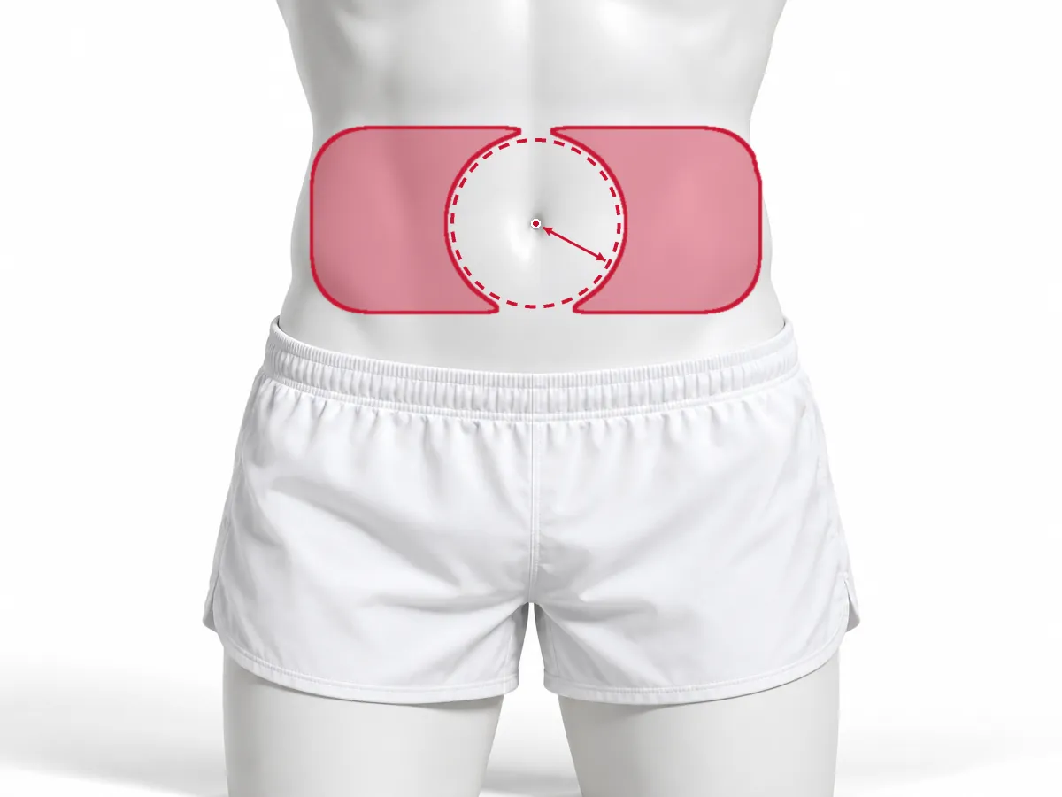 Illustration: Area of the abdomen for a subcutaneous injection, away from the navel
